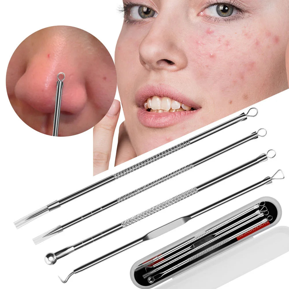 Acne Blackhead Pimple Remover Tool 4pcs/Set Double-ended Stainless Steel