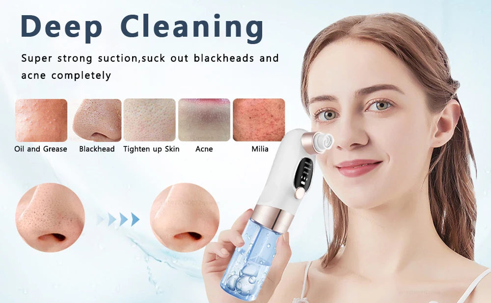 Rechargeable Water Cycle  Blackhead Remover Pore Vacuum