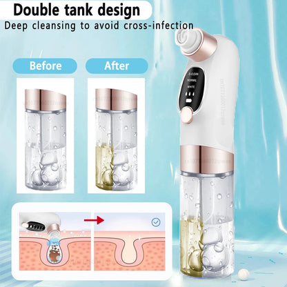 Rechargeable Water Cycle  Blackhead Remover Pore Vacuum