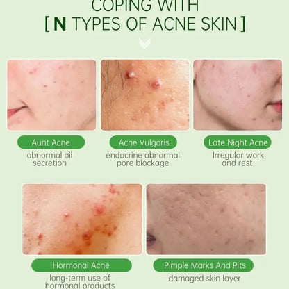 Tea Tree Acne Removal Serum Repair