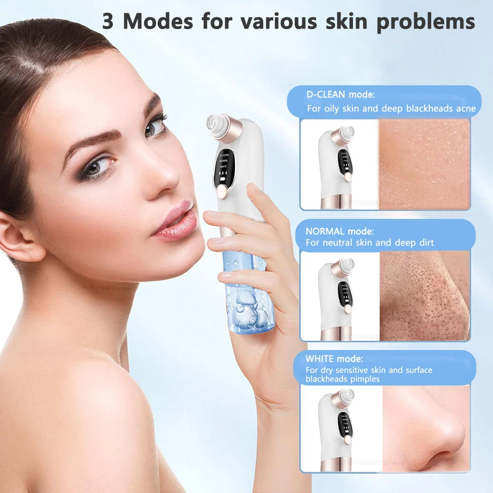 Rechargeable Water Cycle  Blackhead Remover Pore Vacuum