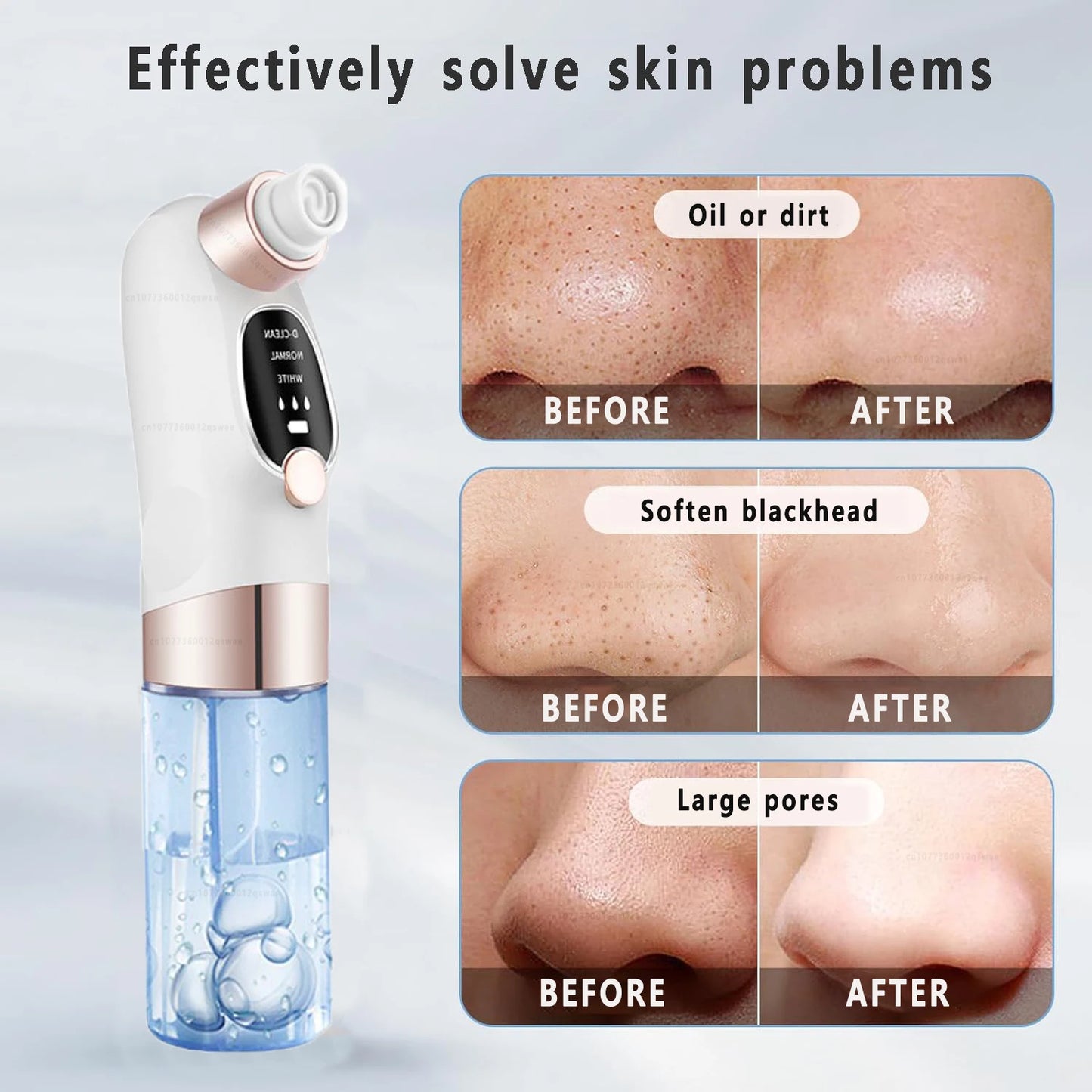 Rechargeable Water Cycle  Blackhead Remover Pore Vacuum