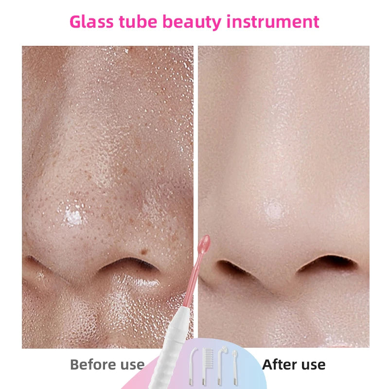 High Frequency Facial Machine Wands Remove wrinkles Inflammation Acne Skin Care