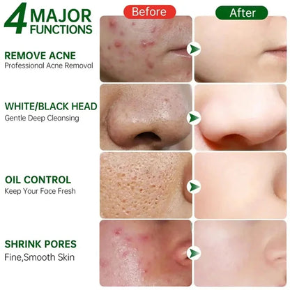 Pore Shrinking Cream Face Tightening Repairing Facial Skin Care