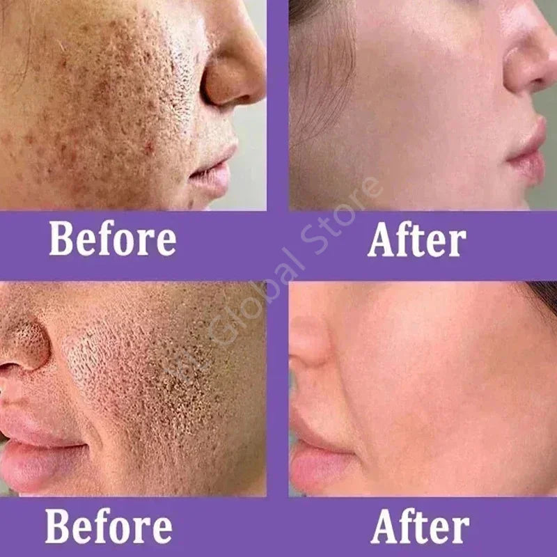 Pore Shrinking Cream Face Tightening Repairing Facial Skin Care