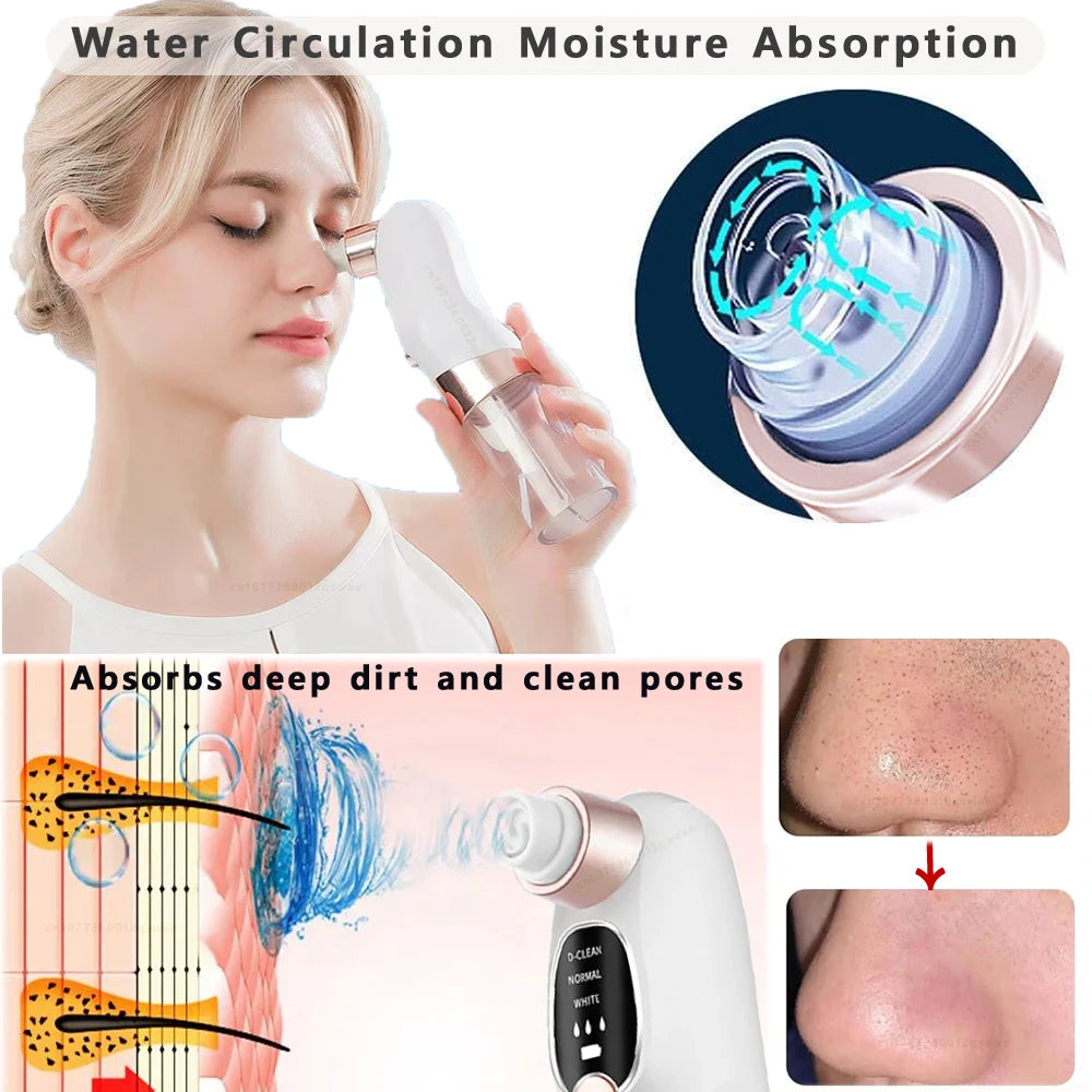 Rechargeable Water Cycle  Blackhead Remover Pore Vacuum